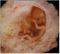 PreBorn Baby at 9 Weeks
